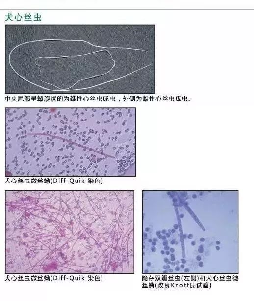 血液,尿液,粪便中常见寄生虫鉴别