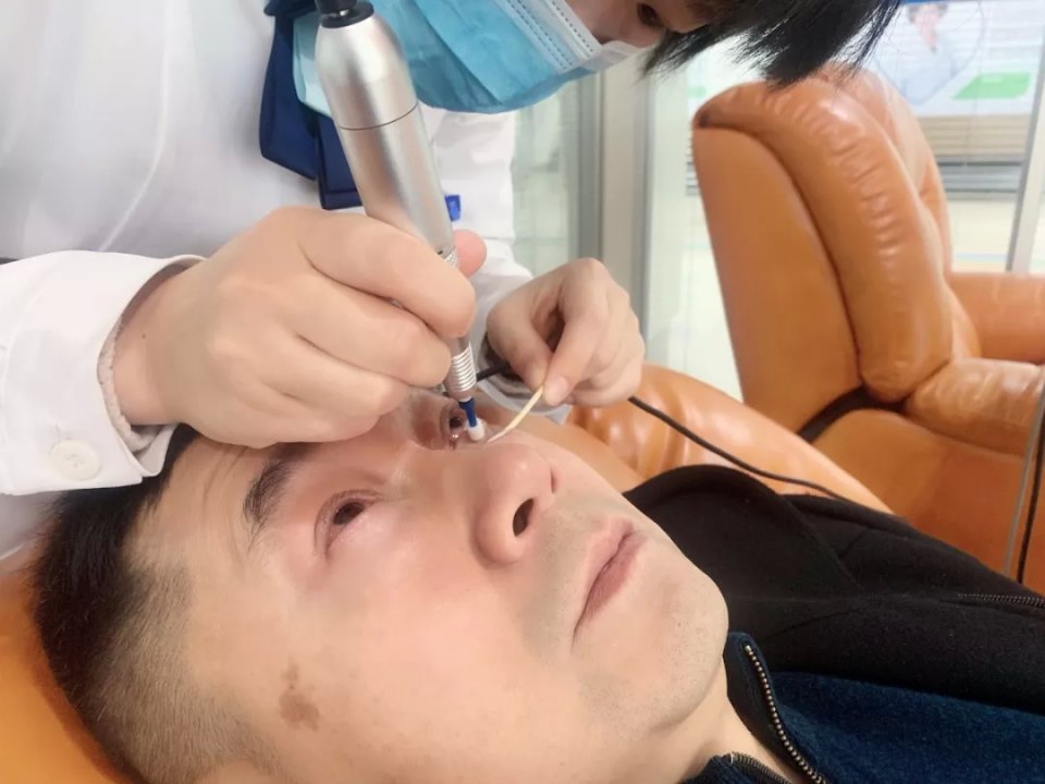 眼科怎么检查发现有螨虫 a9927a91ed014edb8e8991579ec621b1.jpeg