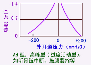 声导抗检查