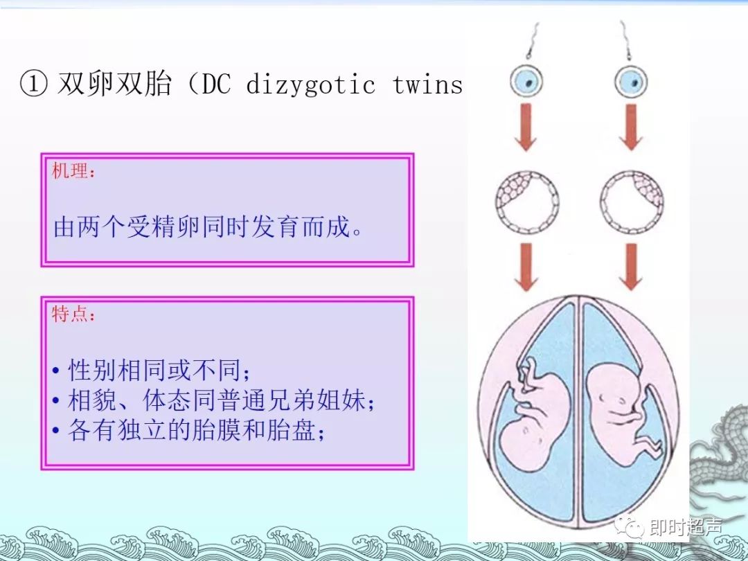 应用人类绝经期促性腺激素(hmg)治疗过程中易发生卵巢过度刺激,以