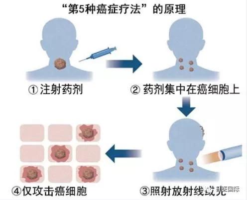 日本癌症的“第五疗法”将在2020年使用！ 