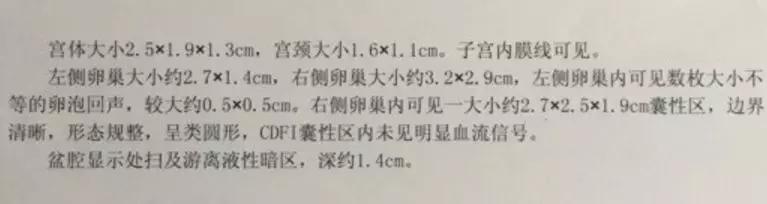 #婴芭莎儿博会#冻结女儿发育，安吉丽娜朱莉又逆天了！
