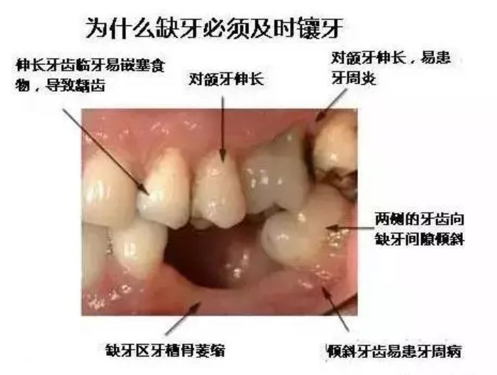 什么口拔牙的成语_拔牙图片卡通(3)