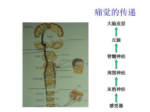 心肌梗塞比例人口_心肌梗塞