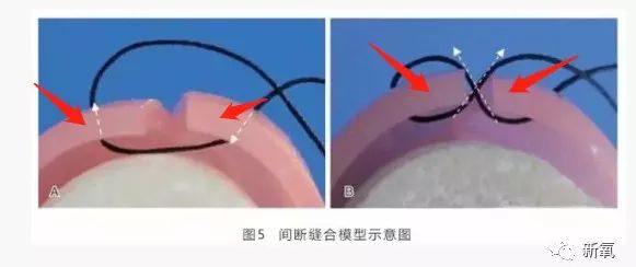 b50bac16ded7434e93f9149cdfb906dd.jpeg