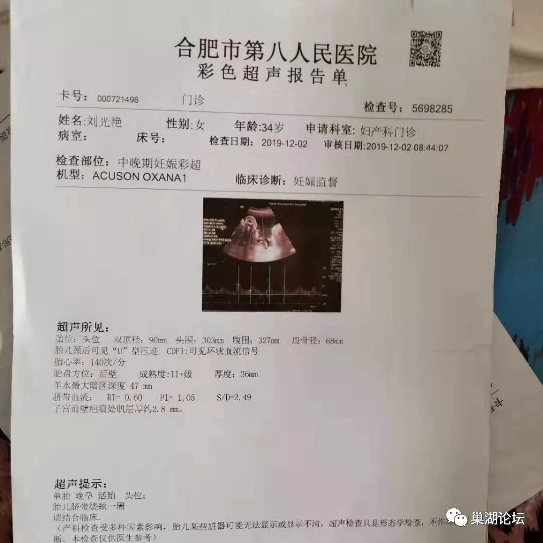 日在巢湖市第八人民医院(原三康)的彩超报告单(状态为死胎)12月11日在