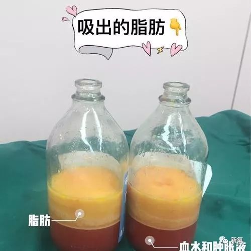 4ceabde223734fd28d79344e3b30684a.jpeg