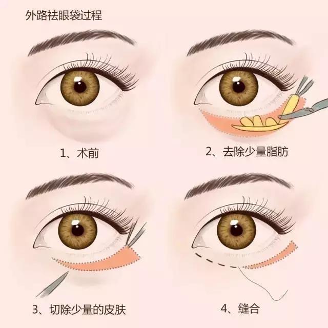 8771daa5a8984868996e3bb309da2b45.JPG