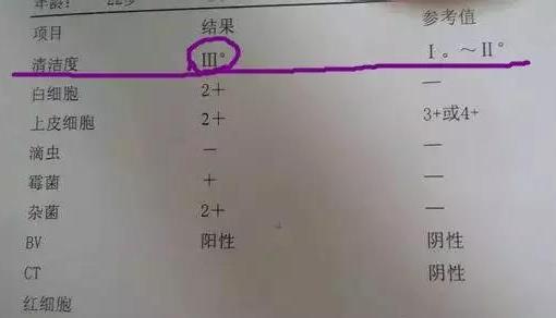 欧宝平台妇科检查报告单看不懂？看这里就够了！(图7)