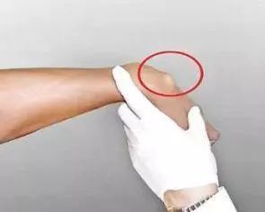 手腕下面突然鼓个大包 aedc9409cf6440268393e072a6fb6b3b.jpeg