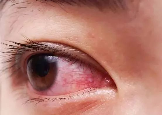 0f418970889947ba94b69ffaff8f1b1f.jpeg