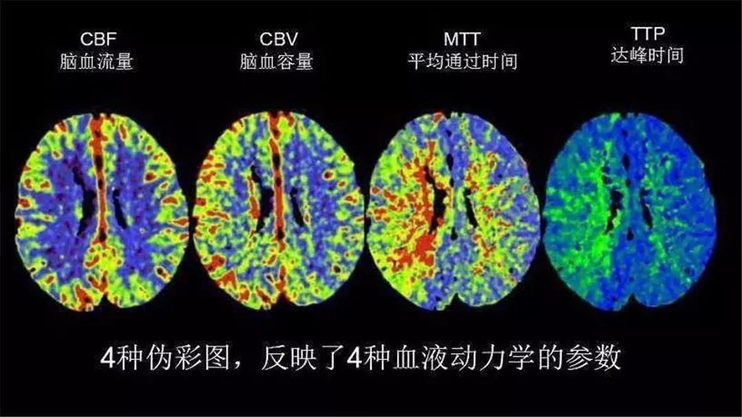 【请您关注】总院云影像中心顺利开展ct脑灌注成像检查