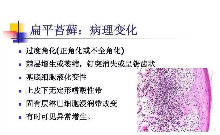 口腔中表现为白色病损的有:迷脂症,颊白线,口腔扁平苔藓,白色水肿