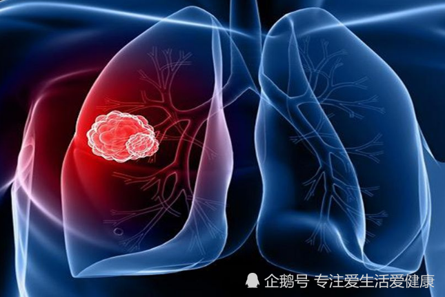 什么是基因突变阳性 9880b2523a4345e89ca29e345ba96f46.png