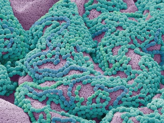 这是在电子显微镜下放大3500倍的牙菌斑照片.