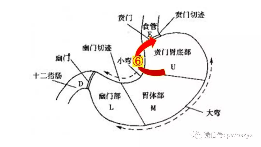 第六步:离断肝胃韧带,解剖贲门后壁及右侧腹膜,离断相关迷走神经,清扫