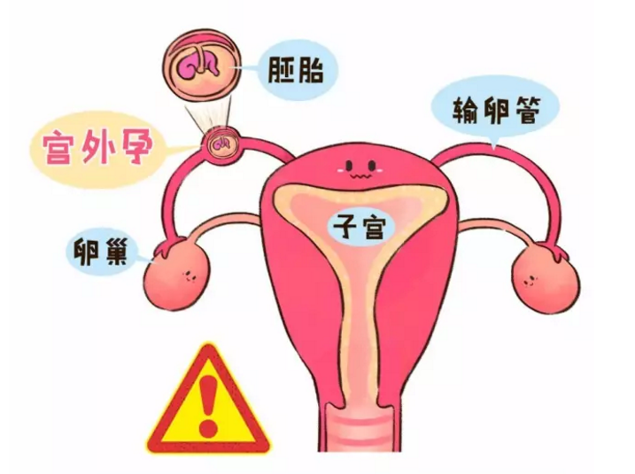 4c59dc64ae78411aa528af60088e91f2.png