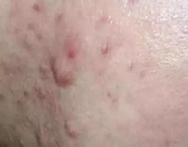 5f3b3c8b6351415ba11820fdf495fa99.JPG