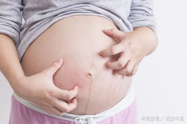 孕晚期出现这3种情况，说明胎儿出现异常，孕妈一定要重视
