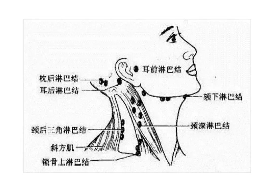 淋巴刮痧一次顶10次消炎点滴!