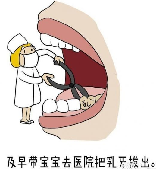 小孩牙齿不掉怎么办