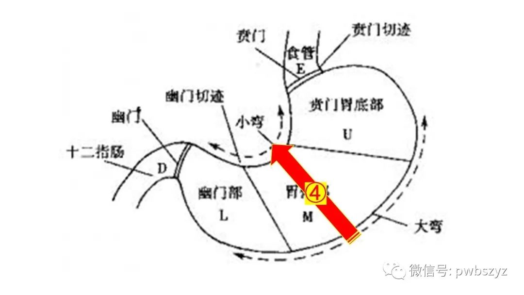 并在胃窦上方肝门正面解剖游离胃右血管(清扫no.3,5及12aln).