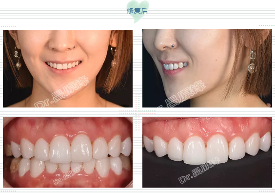 5cdf39808fee41709a9a421d9c47cb3c.png