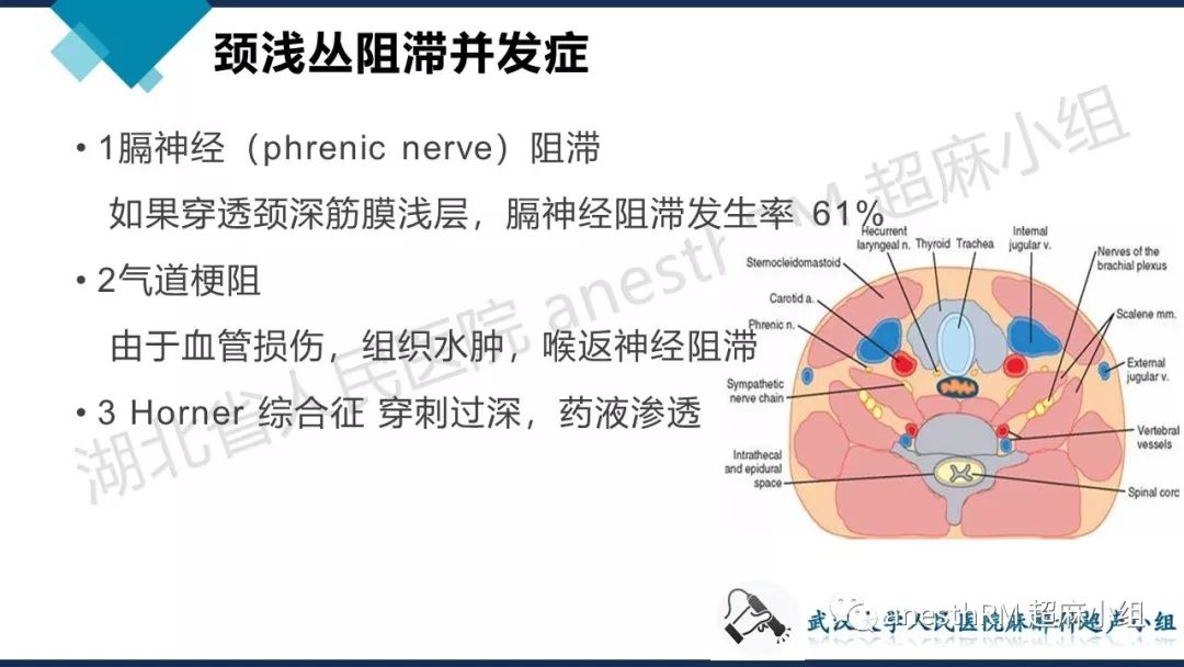 anesthrm 超麻小组  小视频讲解 颈浅丛神经阻滞超声定位 颈浅丛神经