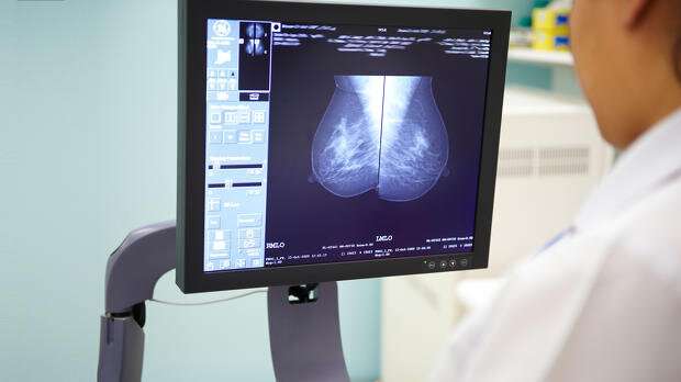 搜狐科学 | 《自然》：人工智能乳腺癌诊断能力或已超越人类 