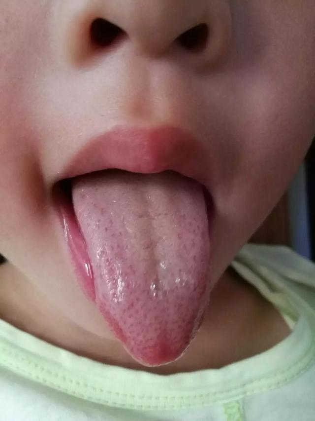 怎么看小孩舌苔厚不厚 d0dbaa76700b46128a4d0815a511cb8e.jpeg