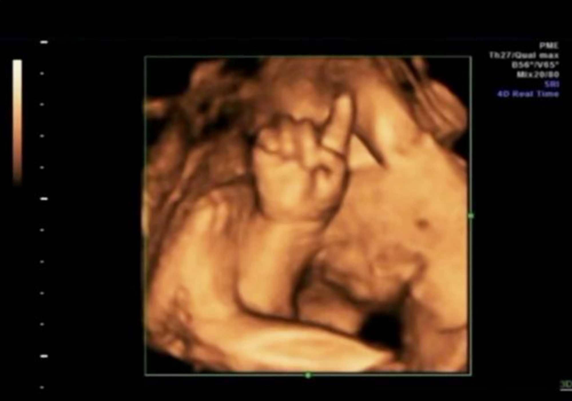 23周孕妈做四维产检,宝宝在肚子里玩"数数",医生:胎教