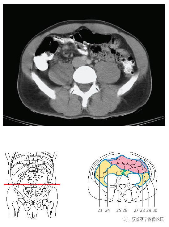 超精细丨腹部断层解剖