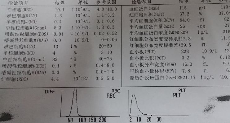 紫癜检查报告怎么看