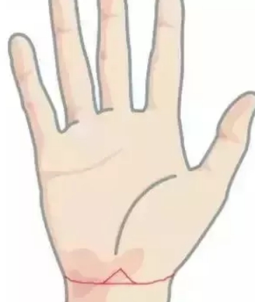 手腕 7c3a2bd13e274b7bb986ccd0ca5ac01a.jpeg