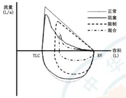 【基层常见疾病诊疗指南】常规肺功能检查基层指南(2018年)