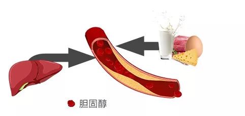 引发胆固醇偏高的原因，除了饮食，还有这5点！