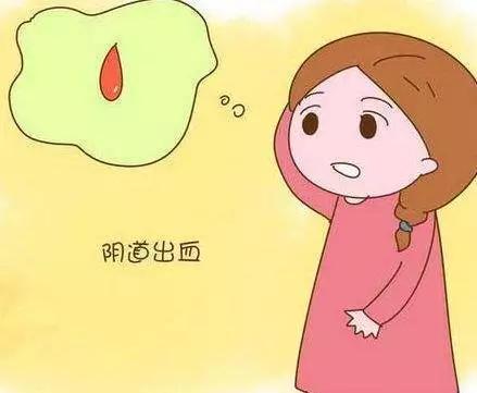 怀孕阴道出血是什么颜色的 4b8f9645b8ca44668e37dd5375237a54.jpeg