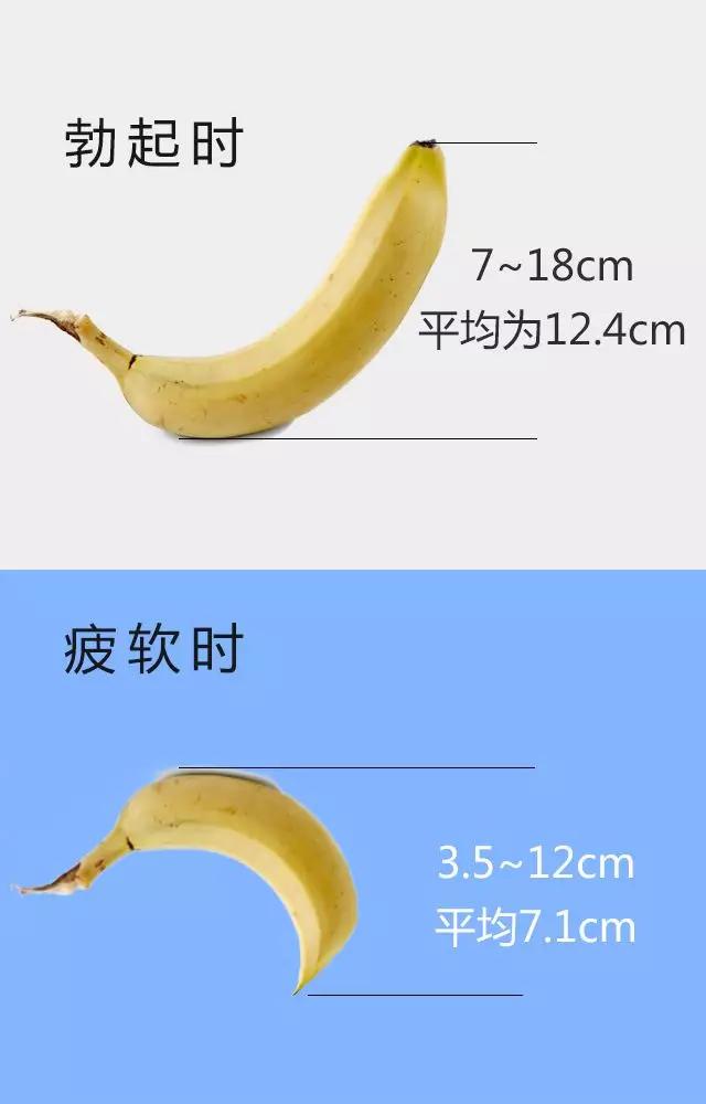 5~12cm,平均7.1cm ;勃起时为7~18cm,平均为12.4cm.