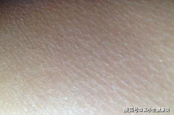 b52d8105596048a8a090b80243b3053c.png