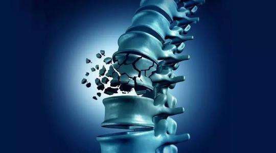 自由基对皮肤有什么影响 c3916af50c3f40e2a0f0b8166f73ffee.jpeg