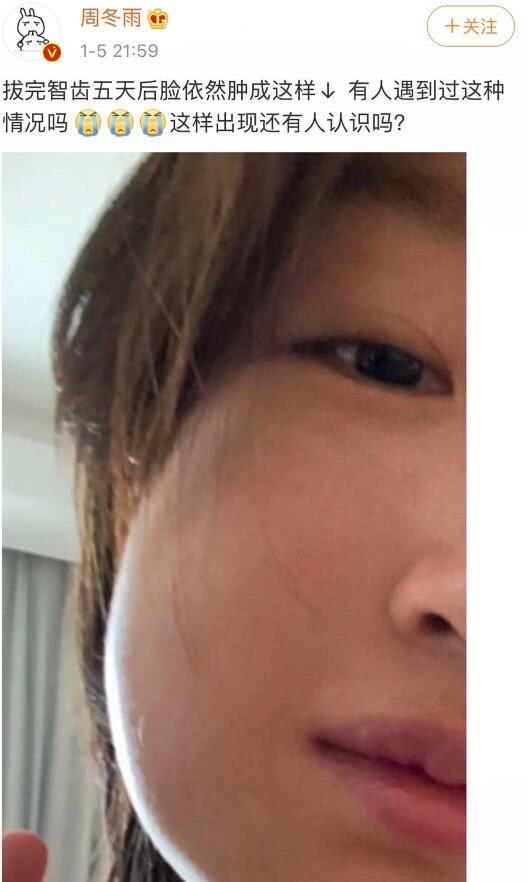 周冬雨拔完智齿脸未消肿戴口罩领奖工作室晒造型图明确表示造型师不