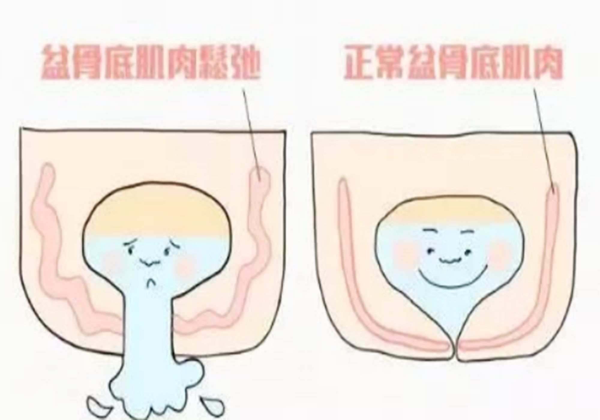 汤唯频繁如厕,ella漏尿2年之久,产后尴尬都是"力"不足