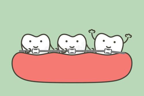想做牙齿矫正被拒，原因竟然是因为这个？！|