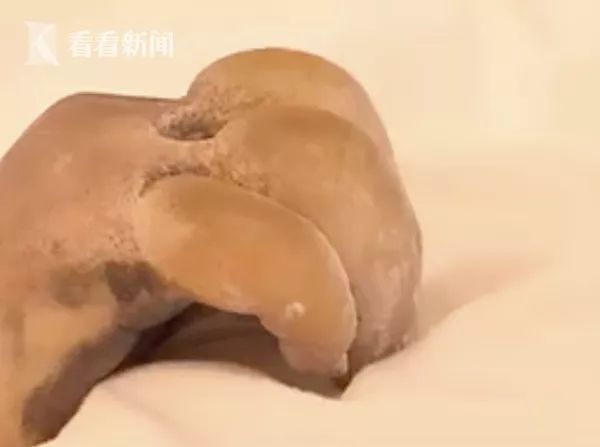 孩子手冻伤了怎么办