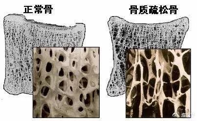 我救你的命，你坑我的钱