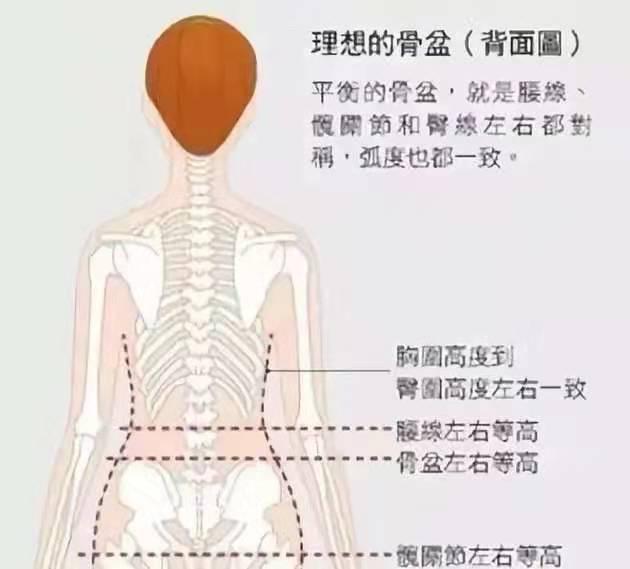 骨盆上下倾斜,骨盆修复该怎么自我调整?分享给大家