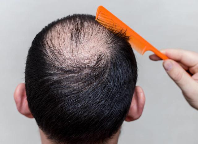 生活中哪些习惯对头发健康有影响？