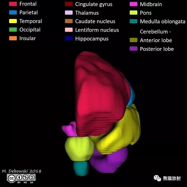 尾状核 lentiform nucleus 豆状核 hippocampus 海马 midbrain 中脑