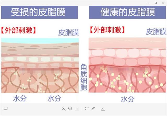 皮肤保护膜坏了怎么办 56f81181e3b840b58764005128ae078a.jpeg