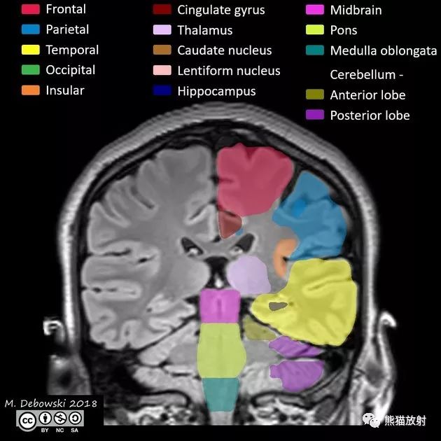 解剖丨脑叶分布(mri图像彩色标注)